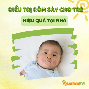 Bé nổi rôm sảy vào mùa hè và cách điều trị hiệu quả tại nhà